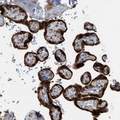 Anti-TRAK2 antibody produced in rabbit Prestige Antibodies® Powered by Atlas Antibodies, affinity isolated antibody, buffered aqueous glycerol solution