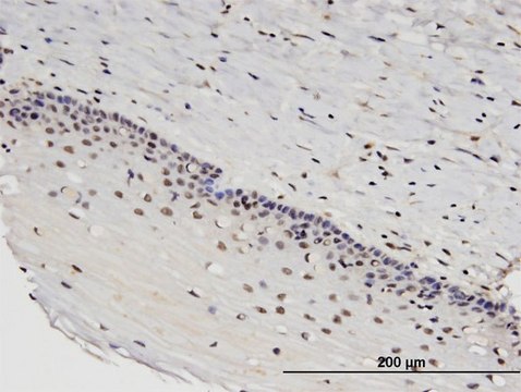 Monoclonal Anti-RTKN2 antibody produced in mouse clone 2C2, purified immunoglobulin, buffered aqueous solution