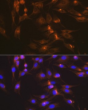 Anti-GLUT2/SLC2A2 antibody produced in rabbit