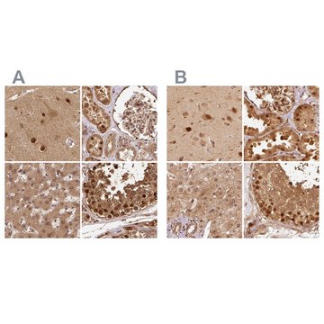 Anti-PSMD1 antibody produced in rabbit Prestige Antibodies&#174; Powered by Atlas Antibodies, affinity isolated antibody, buffered aqueous glycerol solution