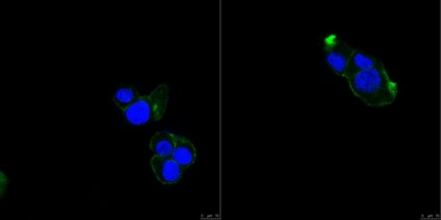 Anti-TRPV2 Antibody, clone 17A11 clone 17A11, from mouse