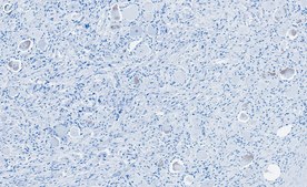 Anti-MRGPRD Antibody, clone 3H7 ZooMAb® Rabbit Monoclonal recombinant, expressed in HEK 293 cells