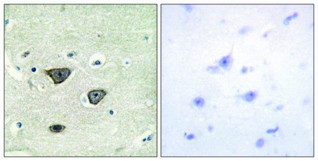 Anti-CDH8 antibody produced in rabbit affinity isolated antibody