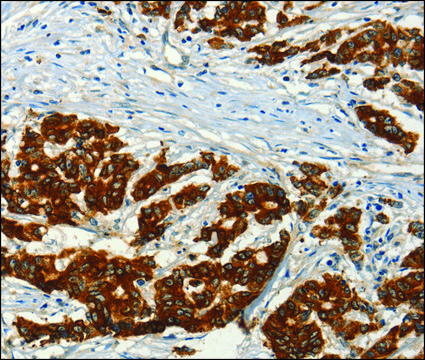 Anti-ADCY3 antibody produced in rabbit affinity isolated antibody