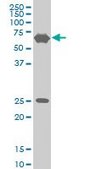 ANTI-TRIM25 antibody produced in mouse clone 5F12, purified immunoglobulin, buffered aqueous solution