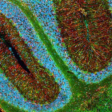 Anti-Neurofilament H Non-Phosphorylated Mouse mAb (SMI-32) liquid, clone SMI-32, Calbiochem&#174;