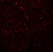Anti-ERAP1 antibody produced in rabbit affinity isolated antibody