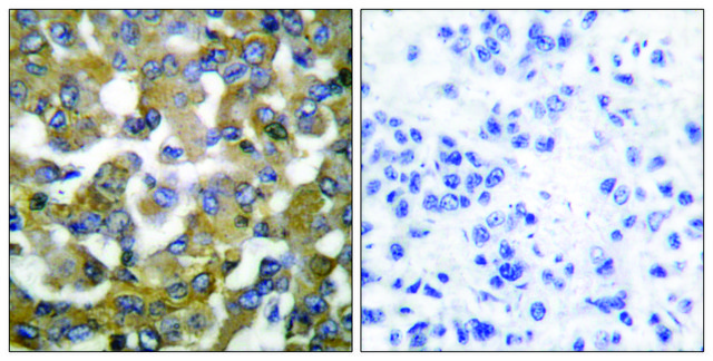 Anti-Keratin 19 antibody produced in rabbit affinity isolated antibody