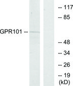 Anti-GPR101 antibody produced in rabbit affinity isolated antibody