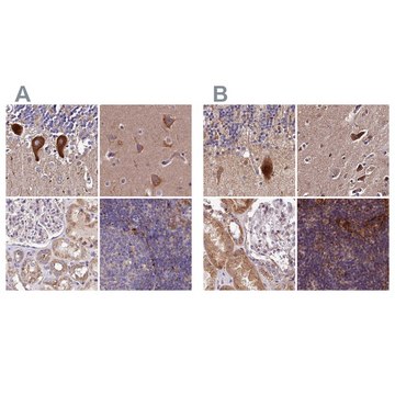 Anti-SPRYD3 antibody produced in rabbit Prestige Antibodies&#174; Powered by Atlas Antibodies, affinity isolated antibody, buffered aqueous glycerol solution