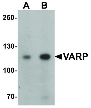 Anti-ANKRD27 antibody produced in rabbit affinity isolated antibody