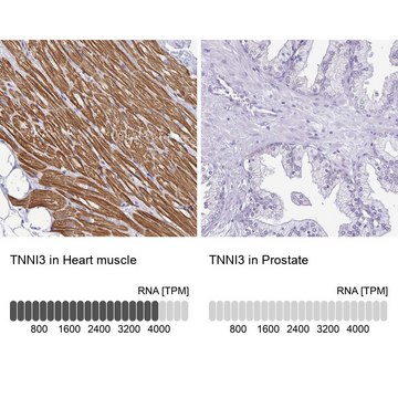 Anti-TNNI3 antibody produced in rabbit Prestige Antibodies&#174; Powered by Atlas Antibodies, affinity isolated antibody, buffered aqueous glycerol solution