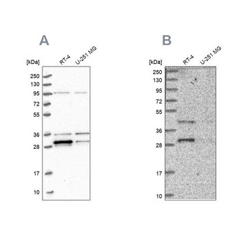 Anti-PPTC7 antibody produced in rabbit Prestige Antibodies&#174; Powered by Atlas Antibodies, affinity isolated antibody, buffered aqueous glycerol solution