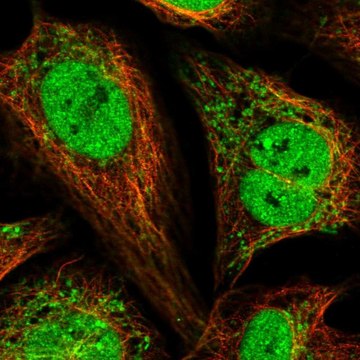 Anti-PAM16 antibody produced in rabbit Prestige Antibodies&#174; Powered by Atlas Antibodies, affinity isolated antibody