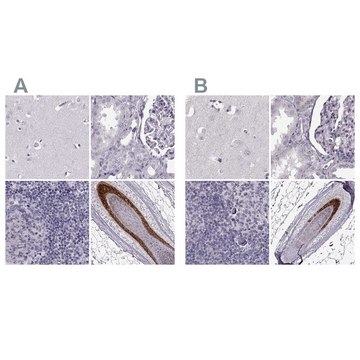 Anti-TCHHL1 antibody produced in rabbit Prestige Antibodies&#174; Powered by Atlas Antibodies, affinity isolated antibody