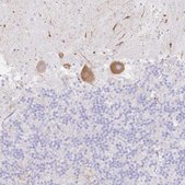 Anti-DKK4 antibody produced in rabbit Prestige Antibodies® Powered by Atlas Antibodies, affinity isolated antibody, buffered aqueous glycerol solution