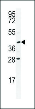 ANTI-USP50 (CENTER) antibody produced in rabbit affinity isolated antibody, buffered aqueous solution