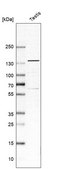 Anti-USP25 antibody produced in rabbit Prestige Antibodies® Powered by Atlas Antibodies, affinity isolated antibody, buffered aqueous glycerol solution