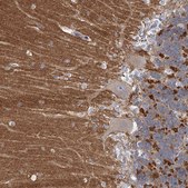 Anti-NLRP10 antibody produced in rabbit Prestige Antibodies® Powered by Atlas Antibodies, affinity isolated antibody, buffered aqueous glycerol solution