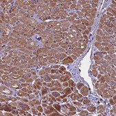 Anti-MIEF2 antibody produced in rabbit Prestige Antibodies® Powered by Atlas Antibodies, affinity isolated antibody, buffered aqueous glycerol solution