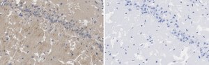 Anti-PSD95 Antibody, clone K28/43 ZooMAb® Mouse Monoclonal recombinant, expressed in HEK 293 cells