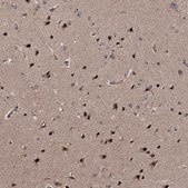 Anti-SUPT20H antibody produced in rabbit Prestige Antibodies® Powered by Atlas Antibodies, affinity isolated antibody, buffered aqueous glycerol solution