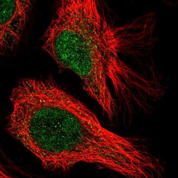 Anti-CENPQ antibody produced in rabbit Prestige Antibodies&#174; Powered by Atlas Antibodies, affinity isolated antibody