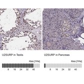 Anti-U2SURP antibody produced in rabbit Prestige Antibodies® Powered by Atlas Antibodies, affinity isolated antibody