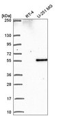 Anti-PIP4K2B antibody produced in rabbit Prestige Antibodies® Powered by Atlas Antibodies, affinity isolated antibody