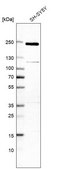 Anti-TSC2 antibody produced in rabbit Prestige Antibodies® Powered by Atlas Antibodies, affinity isolated antibody, buffered aqueous glycerol solution