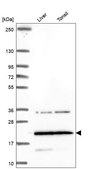 Anti-Tm4Sf18 Antibody Produced In Rabbit Prestige Antibodies® Powered by Atlas Antibodies, affinity isolated antibody, buffered aqueous glycerol solution