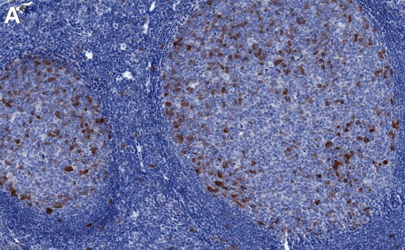 Anti-Aurora A Antibody, clone 1B17 ZooMAb&#174; Rabbit Monoclonal recombinant, expressed in HEK 293 cells