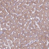 Anti-HSD3B7 antibody produced in rabbit Prestige Antibodies® Powered by Atlas Antibodies, affinity isolated antibody, buffered aqueous glycerol solution