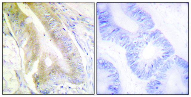 Anti-IREB1 antibody produced in rabbit affinity isolated antibody