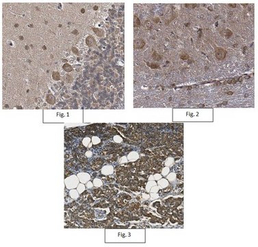 抗-TRPA1抗体 from rabbit, purified by affinity chromatography