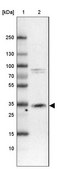 Anti-CTSZ antibody produced in rabbit Prestige Antibodies® Powered by Atlas Antibodies, affinity isolated antibody, buffered aqueous glycerol solution