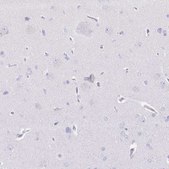 Anti-CD177 antibody produced in rabbit Prestige Antibodies® Powered by Atlas Antibodies, affinity isolated antibody