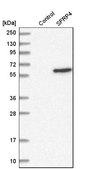 Anti-SFRP4 antibody produced in rabbit Prestige Antibodies® Powered by Atlas Antibodies, affinity isolated antibody, buffered aqueous glycerol solution