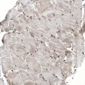 Anti-ZNF266 antibody produced in rabbit Prestige Antibodies® Powered by Atlas Antibodies, affinity isolated antibody, buffered aqueous glycerol solution