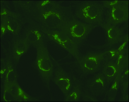 抗 TGN38 兔抗 ~1&#160;mg/mL, affinity isolated antibody, buffered aqueous solution