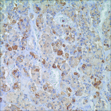 FSH Rabbit Polyclonal Antibody