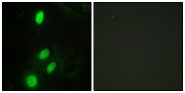 Anti-ETV6 antibody produced in rabbit affinity isolated antibody