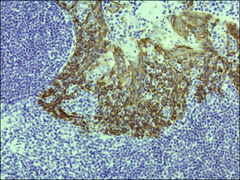 Anti-Cytokeratin 5 antibody, Rabbit monoclonal recombinant, expressed in HEK 293 cells, clone RM226, purified immunoglobulin