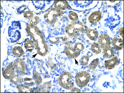 Anti-CBX4 antibody produced in rabbit affinity isolated antibody