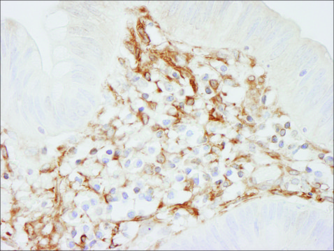 Rabbit anti-Filamin A Antibody, Affinity Purified Powered by Bethyl Laboratories, Inc.