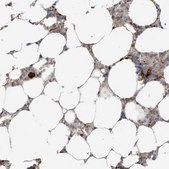 Anti-RHOH antibody produced in rabbit Prestige Antibodies® Powered by Atlas Antibodies, affinity isolated antibody, buffered aqueous glycerol solution