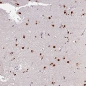 Anti-ARL14EP antibody produced in rabbit Prestige Antibodies® Powered by Atlas Antibodies, affinity isolated antibody, buffered aqueous glycerol solution
