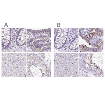 Anti-ANKRD45 antibody produced in rabbit Prestige Antibodies&#174; Powered by Atlas Antibodies, affinity isolated antibody, buffered aqueous glycerol solution, ab1