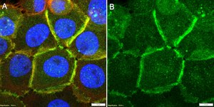 Anti-CTNND1/p120CTN Antibody, clone 2C22 ZooMAb® Rabbit Monoclonal recombinant, expressed in HEK 293 cells