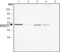 Anti-DYX1C1 (N-terminal) antibody produced in rabbit ~1.5 mg/mL, affinity isolated antibody